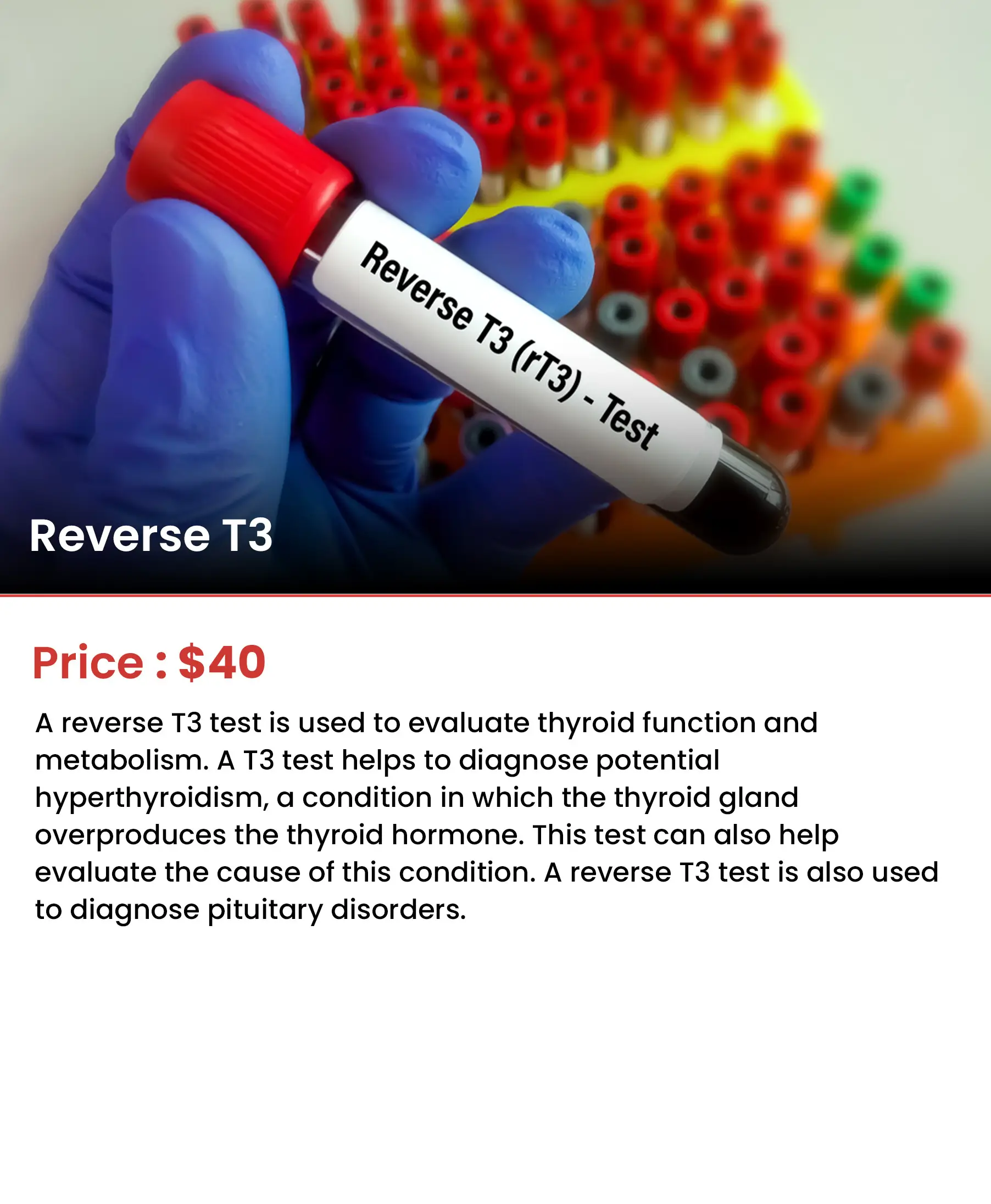 Reverse T3