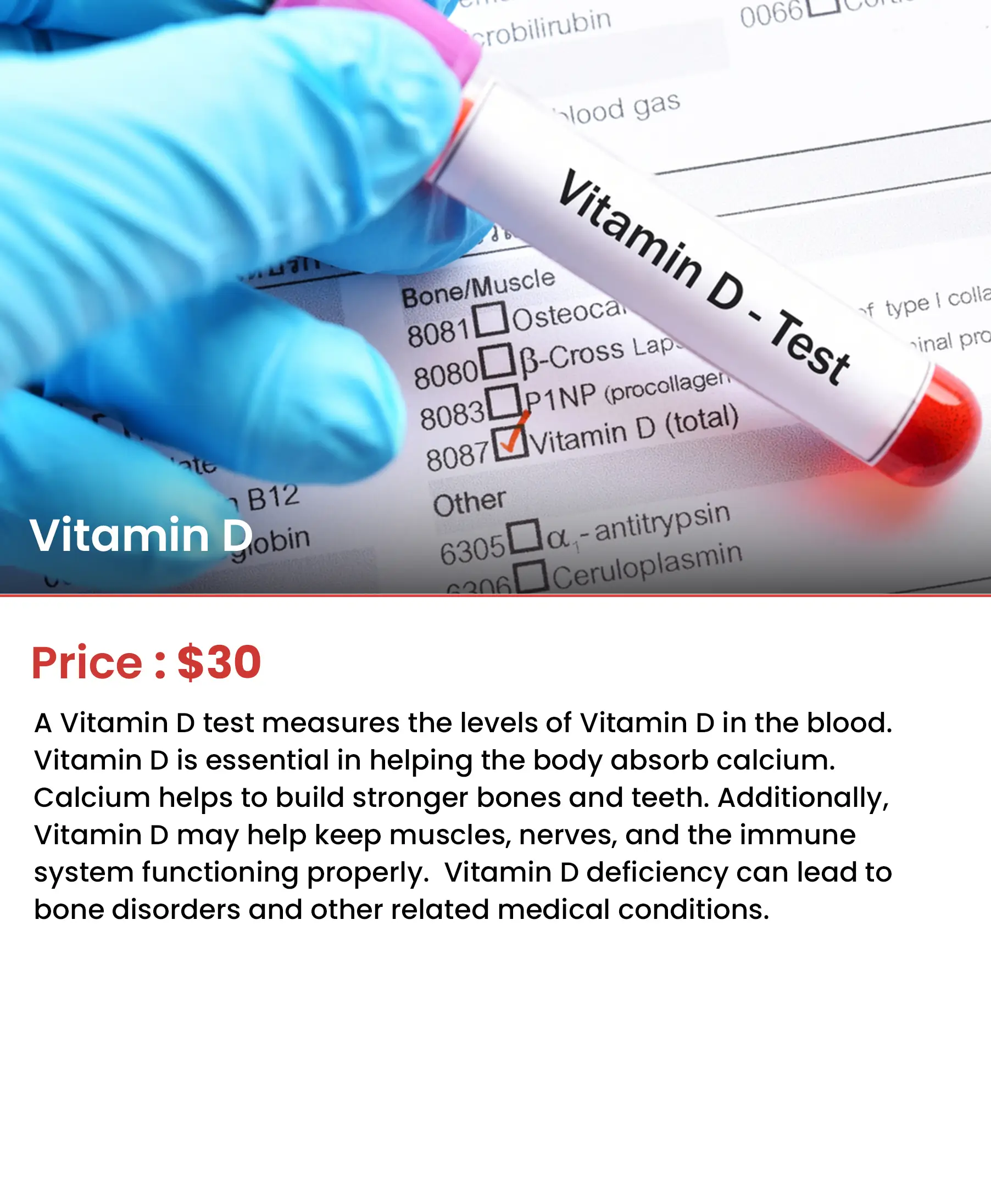 Vitamin D